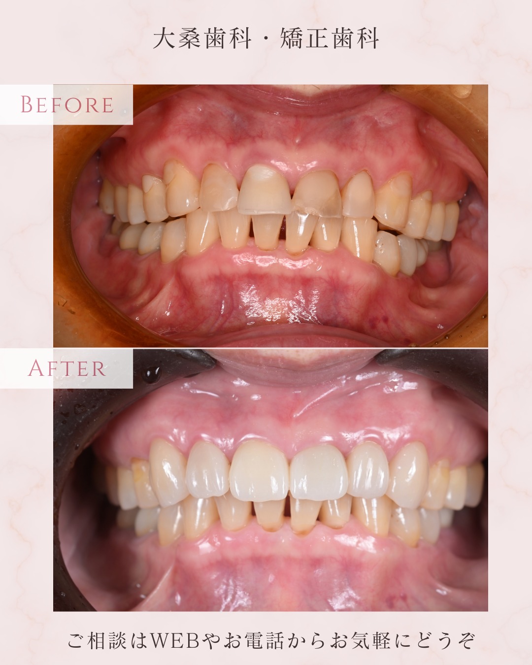 こんにちは大桑歯科・矯正歯科のHです