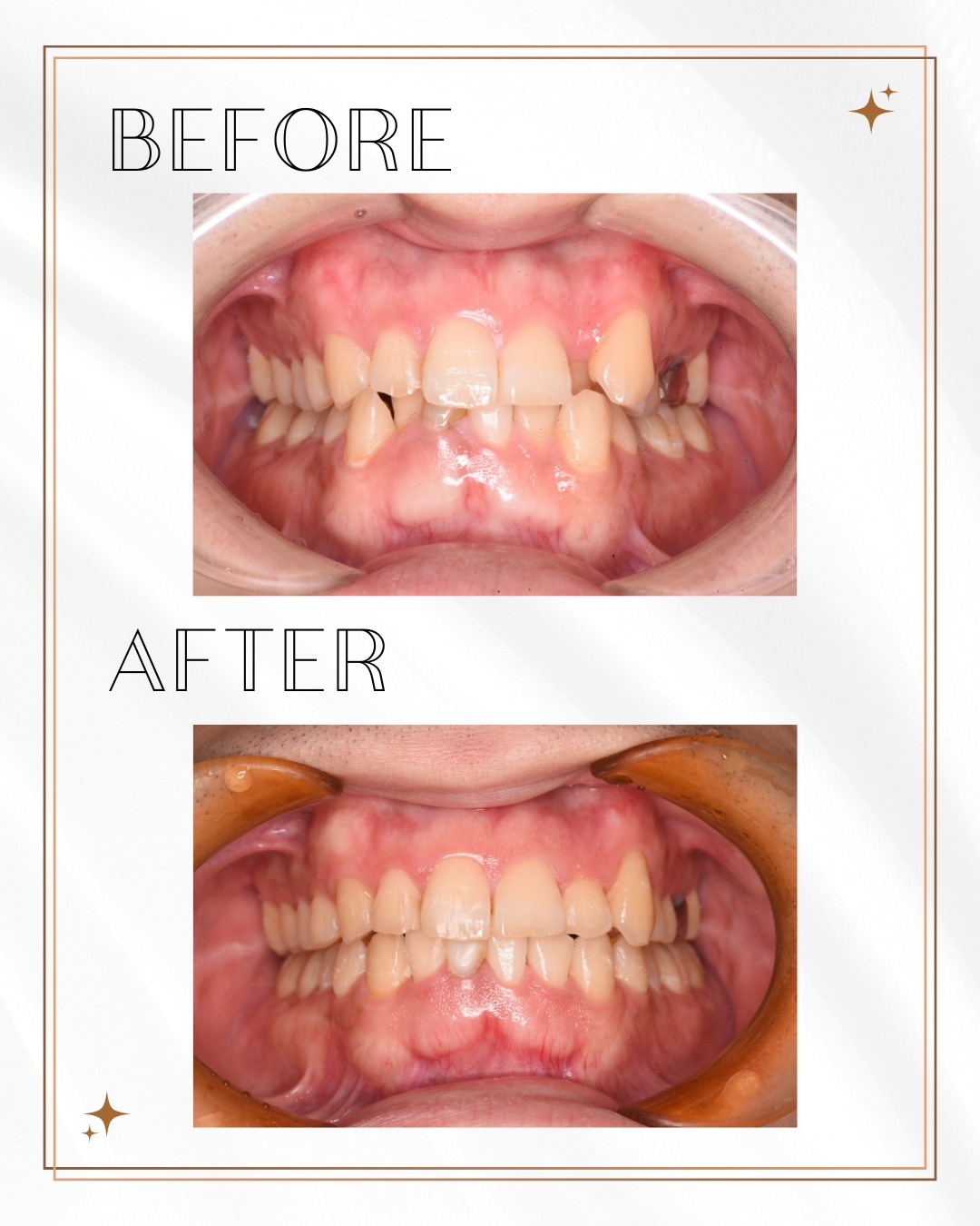こんにちは大桑歯科です