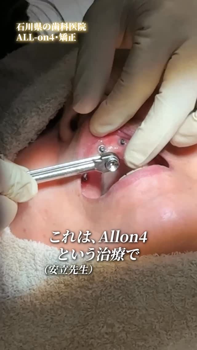 治療の一部動画です