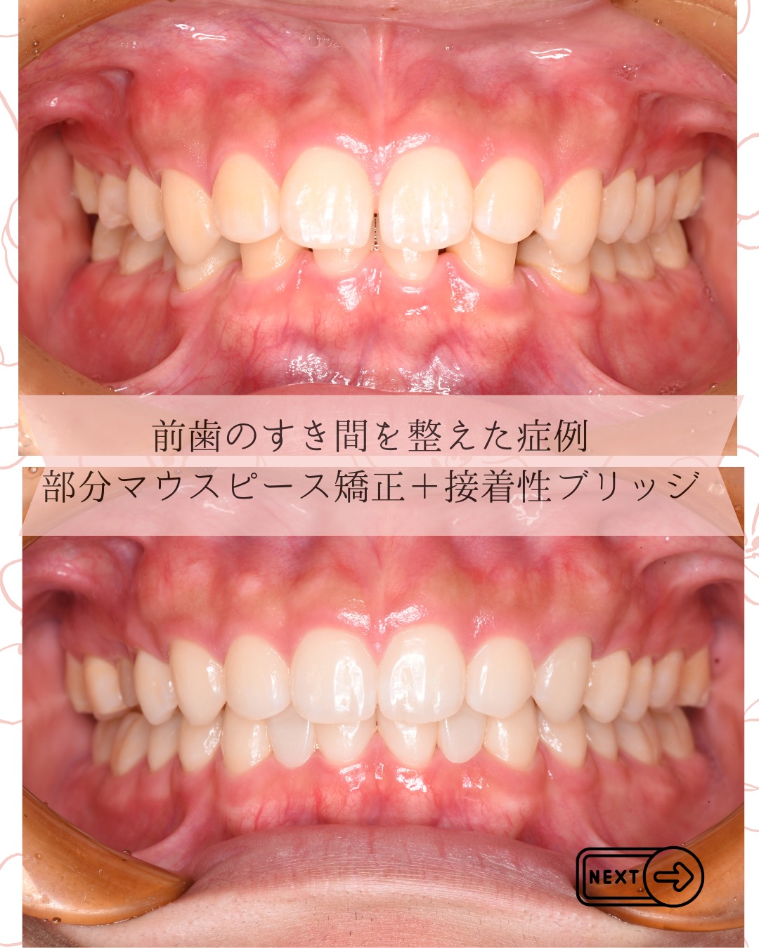 こんにちは大桑歯科・矯正歯科DHのHです