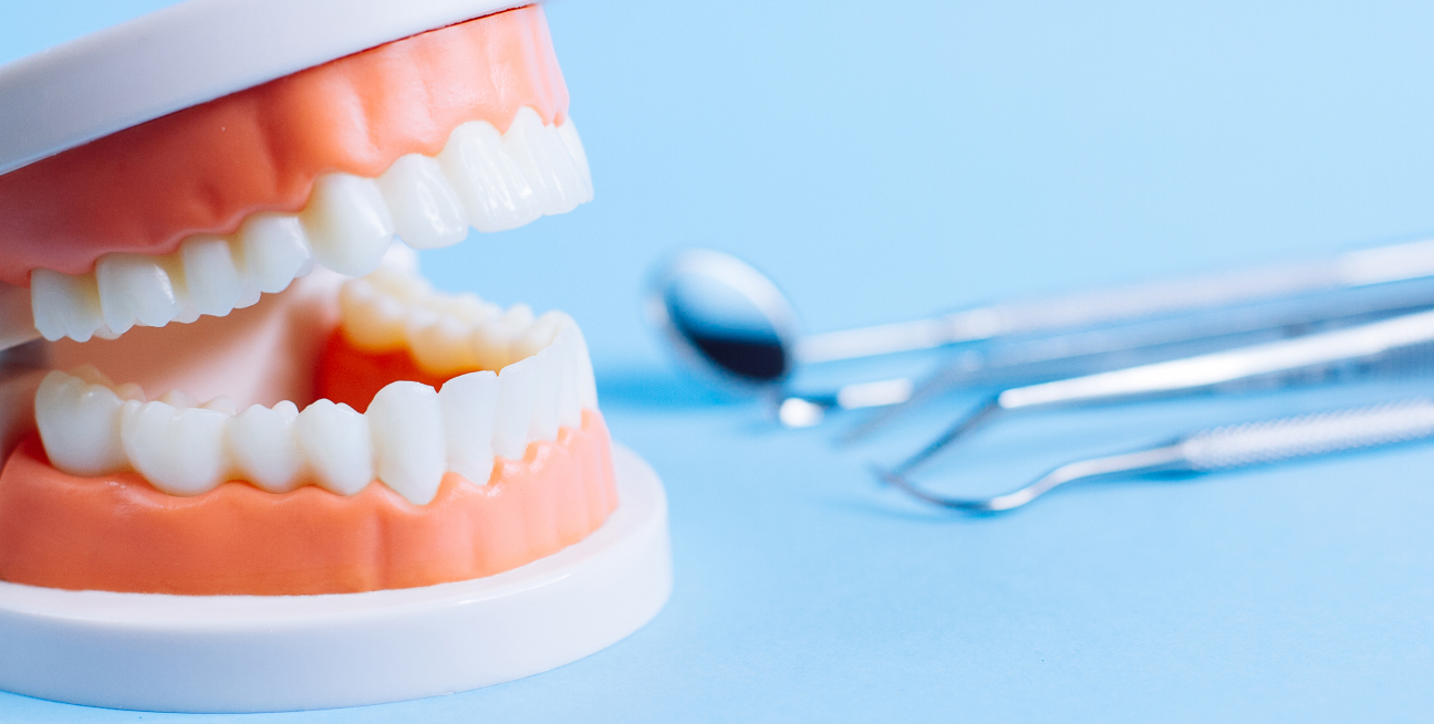 デジタル精密設計×審美再建“美しく噛めるAll-on-4”