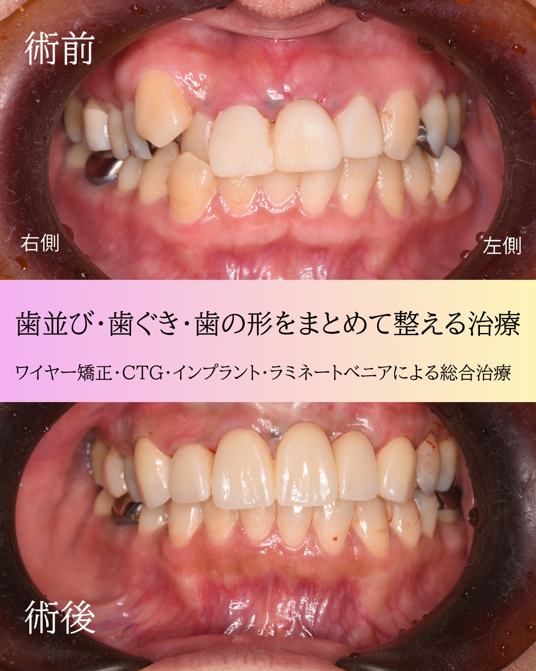 こんにちは大桑歯科・矯正歯科DHのHです