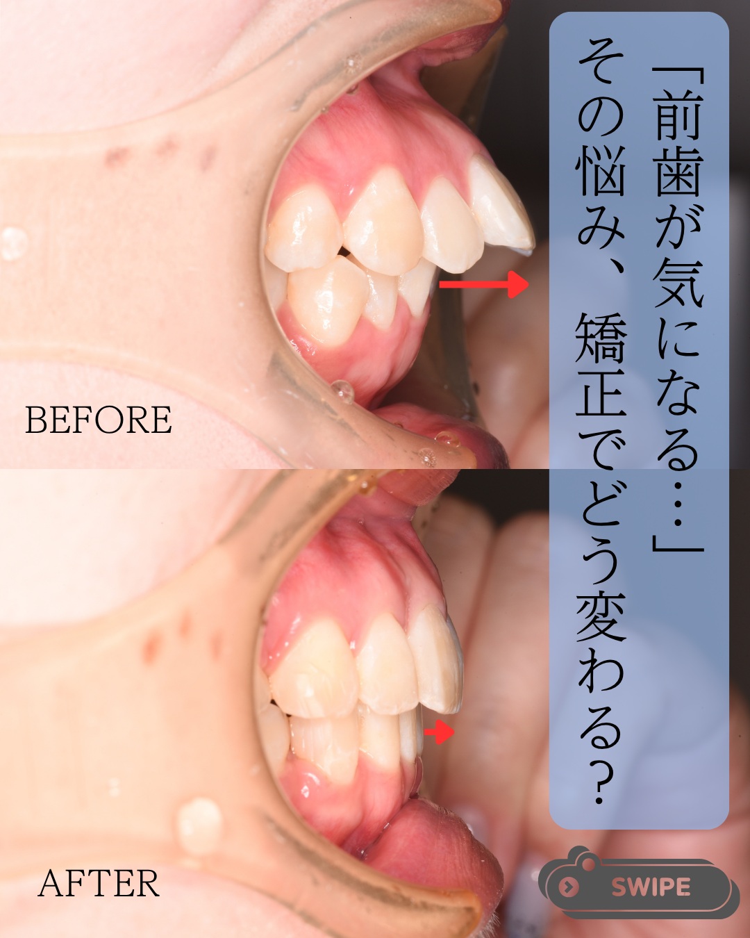 こんにちは大桑歯科・矯正歯科DHのHです