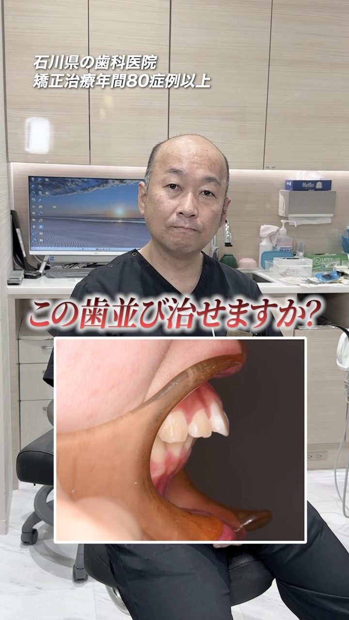 この歯並び、直せますか？